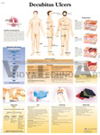 Decubitus Ulcers - Anatomical Chart